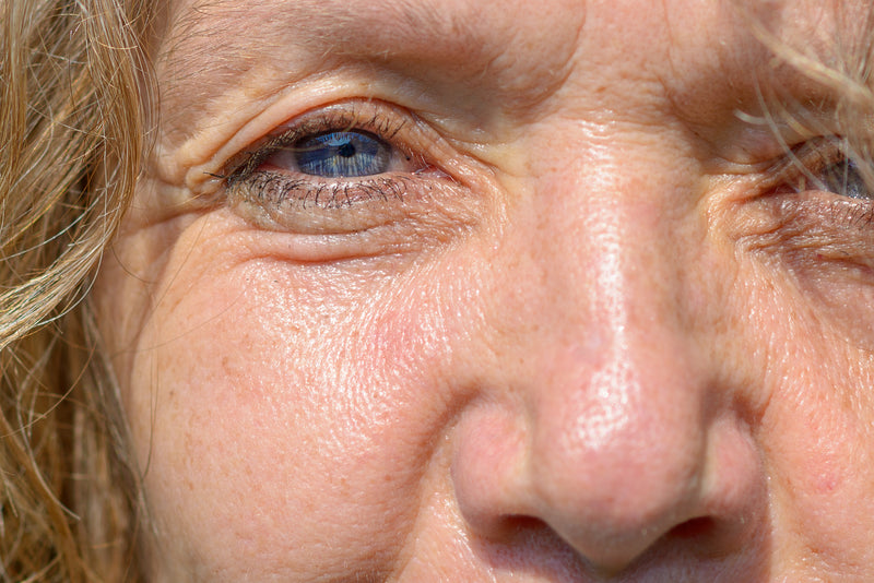 Skin Firmness Loss and Red_Near-Infrared_Light_Therapy